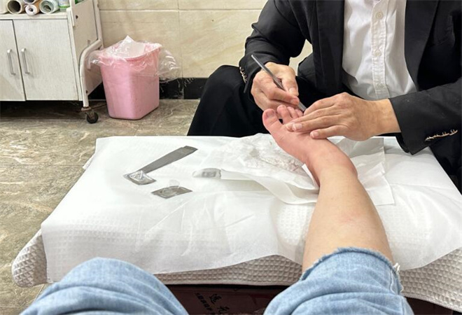 郑远元修脚